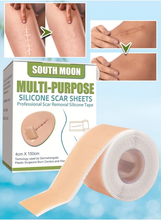 SOUTH MOON Multi Purpose Silicone Scar Sheets Medical Grade Silicone Roll -150cm,Silicone Scar Tape Keloid,C-Section,Surgical Scars Removal Scar Roll Silicon Gel Cream Patch Removes Abs Tuck Surgery Scars Scar Removal Strips  - Image 1