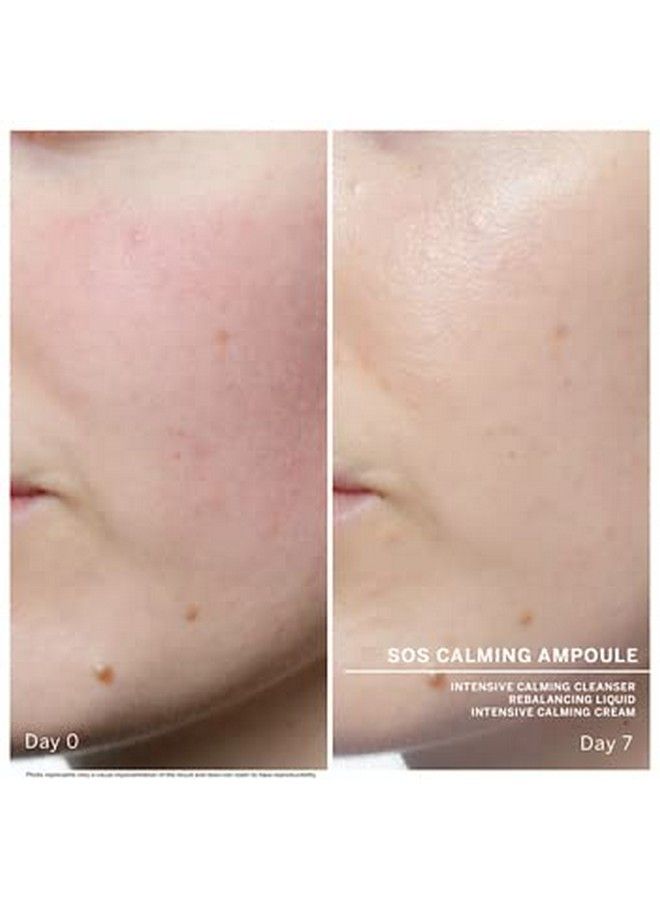 Babor Sos Calming Ampoule Serum Concentrates Soothing Serum To Treat Irritated Skin Reduce Redness And Strengthen Skin Barrier 7 Day Treatment - Image 4