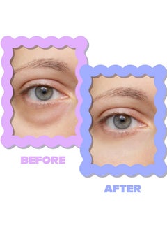 Tintark DIAMOND GAZE Under Eye Patches 28 Pairs, Rejuvenate Eye Area, Soothing Hydrate Brighten Skin, Plumps Fine Lines, Hydrogel Eye Mask with Retinol, Niacinamide and Polyglutamic Acid, Eye Gel Pads  - Image 5