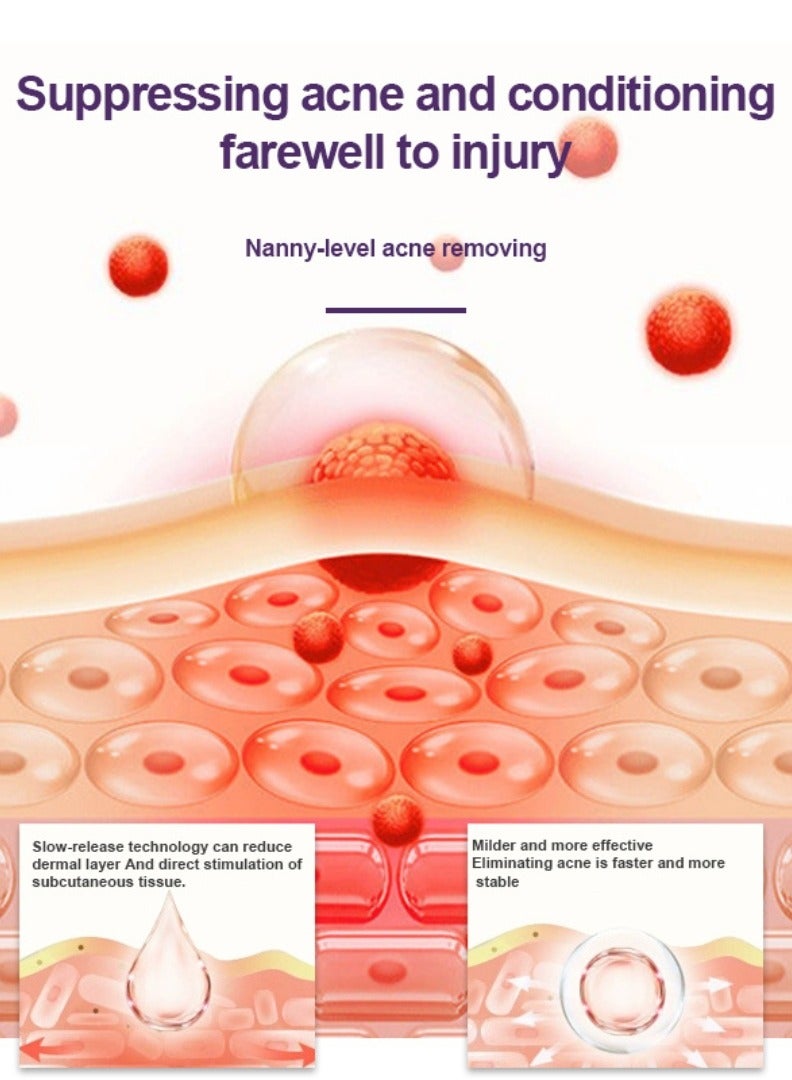 DERMFREE Adapalene Gel Acne Treatment Acne Treatment Cream Acne Treatment Ointment Gel Acne Relief Cream Gentle Moisturizing Acne Removing Gel Pimple and Acne Removal Anti Acne Gel 20g - Image 4