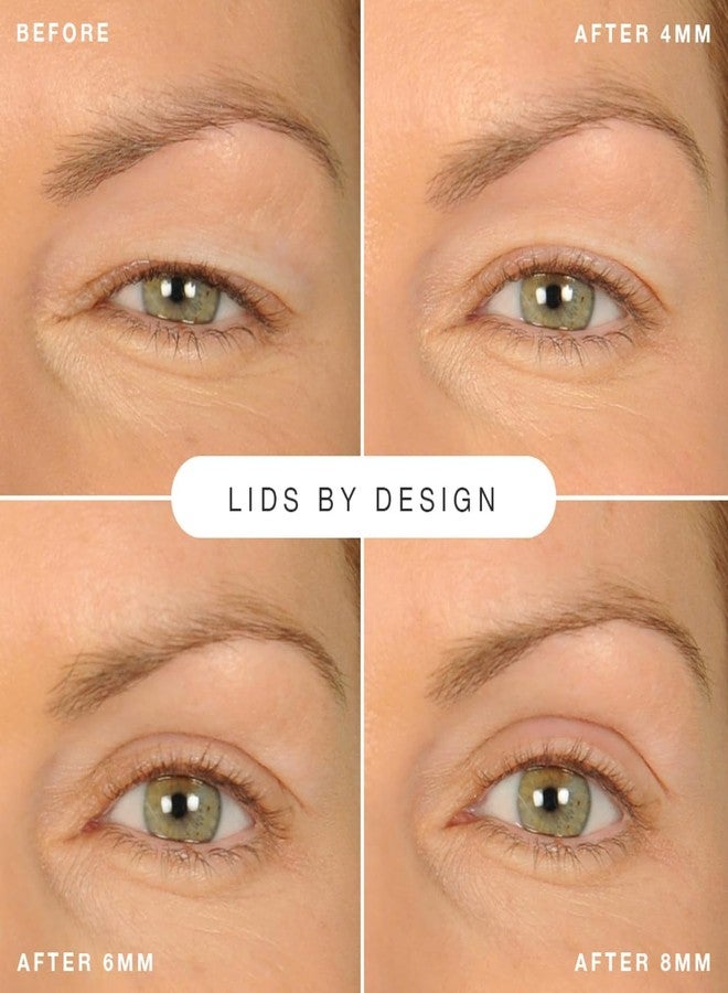 Contours Rx Lids by Design - Non-Surgical & Transparent Eyelid Lift Strips - for a More Youthful-Looking Appearance, Lid Lifting Treatment, Eyelid Tape for Hooded Eyes (5mm)160ct - Image 3