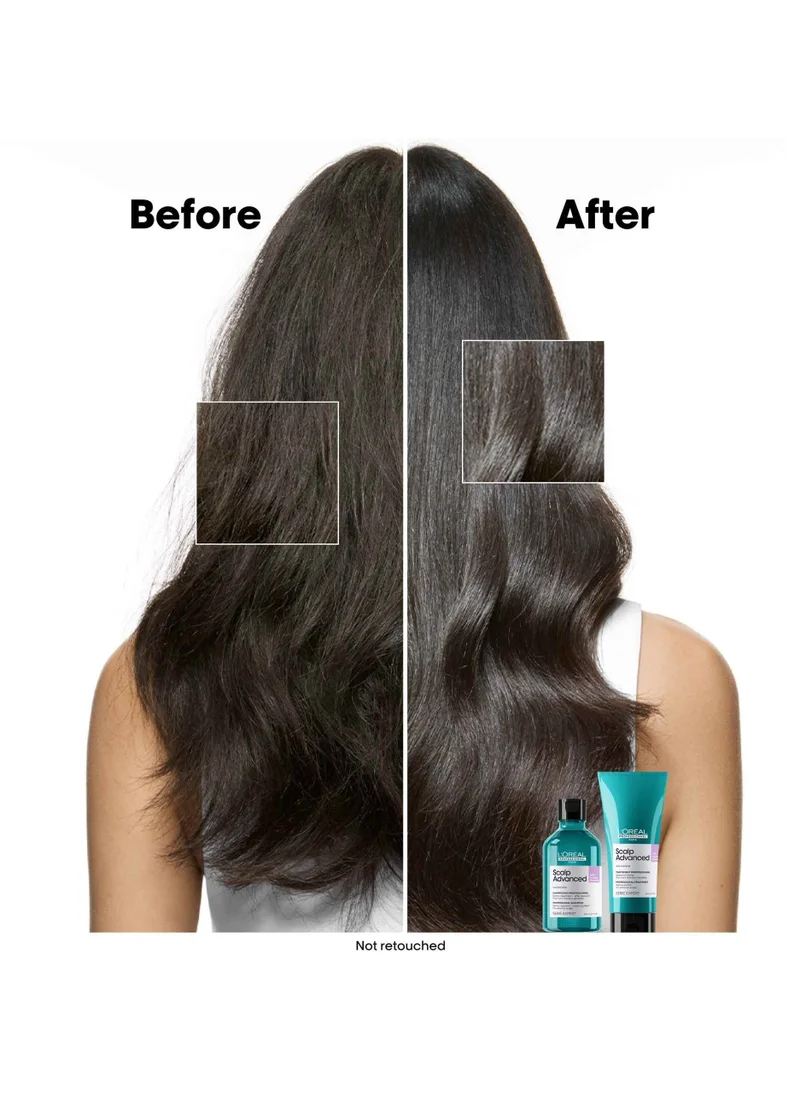 L'Oréal Professionnel Scalp Advanced: Anti-discomfort Glacial Utopia Duo Set, Shampoo 300ml & Treatment 200ml, 20% Savings