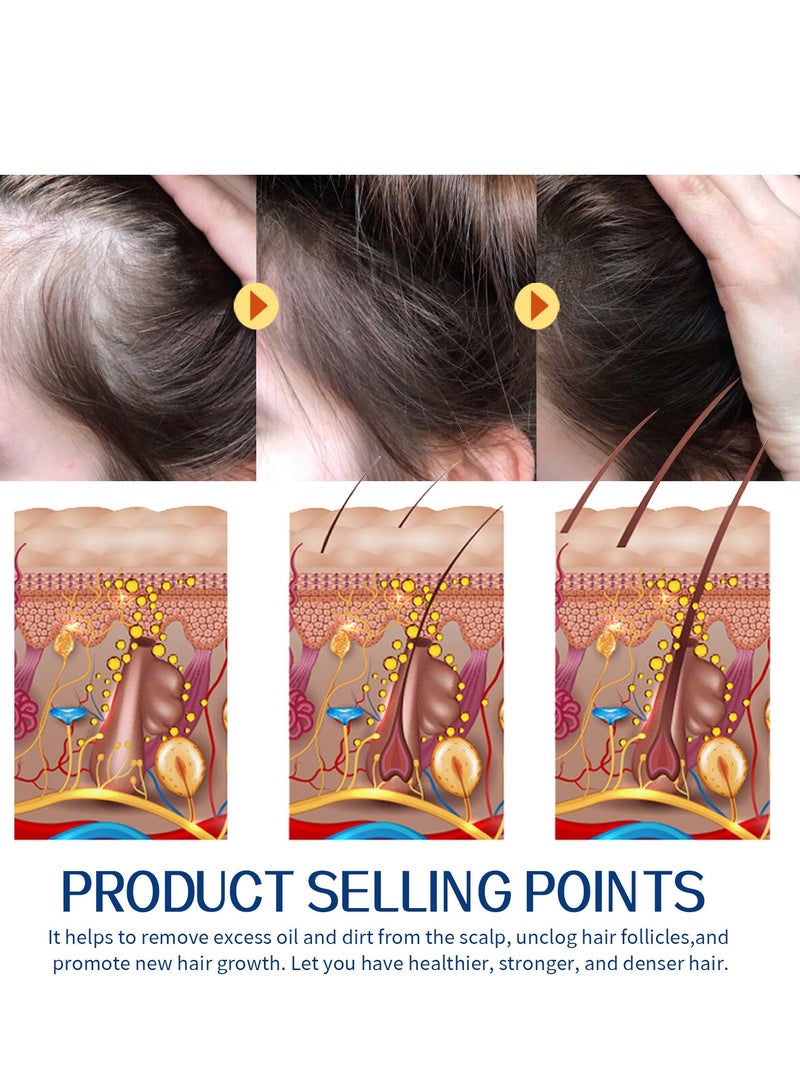 EELHOE Exfoliating Scalp Scrub, Dandruff Itch Treatment, Hair Detox Scrub, Sulfate-Free Scrub Soothes Dry, Flaky, Itchy Scalp, Removes Buildup - Image 3