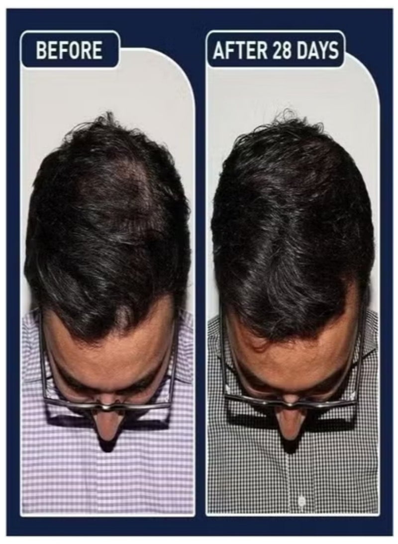 فيج رذاذ مصل الشعر من FEG عبوة مزدوجة 50 مل لتكثيف وتقوية الشعر - Image 2