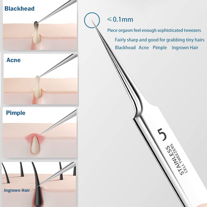 Jedrey 2Pcs Professional Facial Blackhead Remover Tweezers and Pimple Extractor Acne Treatment Tool for Acne Pimples Comedowns Blemishes or Splinters Removal - Image 2