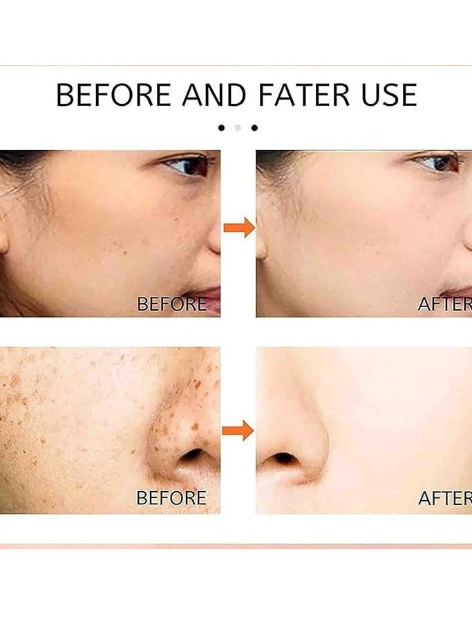 Whitening Labs Melasma 20g White DarkSpots Remover Quickly Keting Green 3 Piece - Image 3