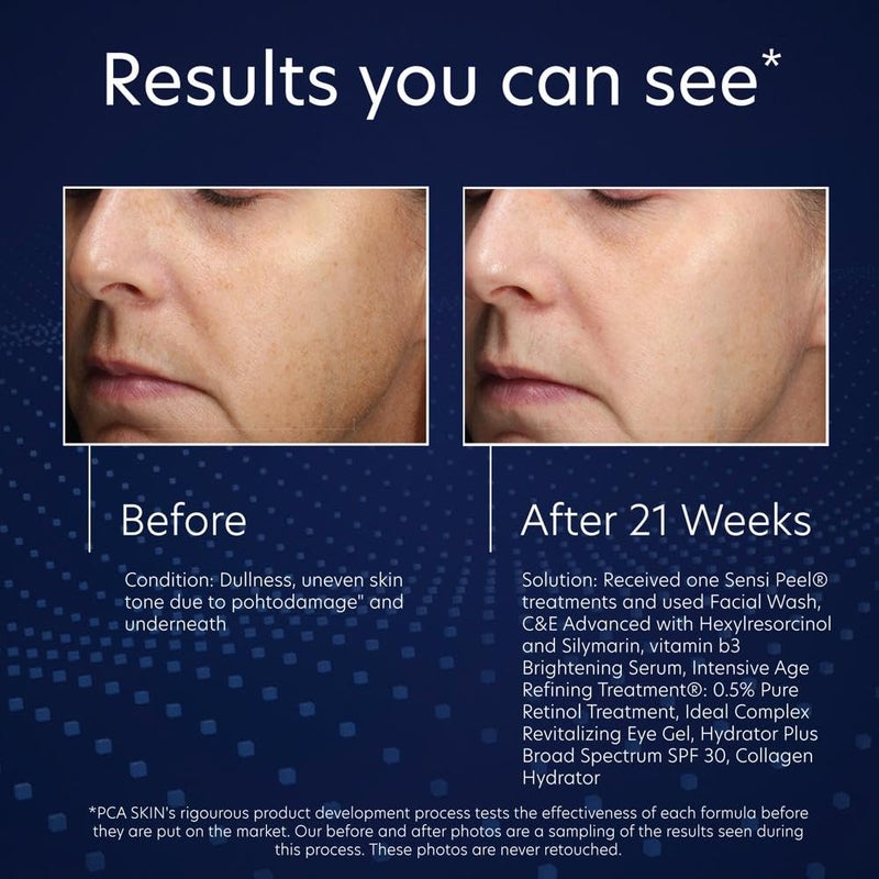 PCA SKIN Vitamin B3 Brightening Serum, Anti Aging Serum for Dark Spots and Skin Discoloration, Made with Hydrating Niacinamide and Antioxidants, Helps Minimize Redness and Uneven Skin Tones, 1.0 Pump - Image 5