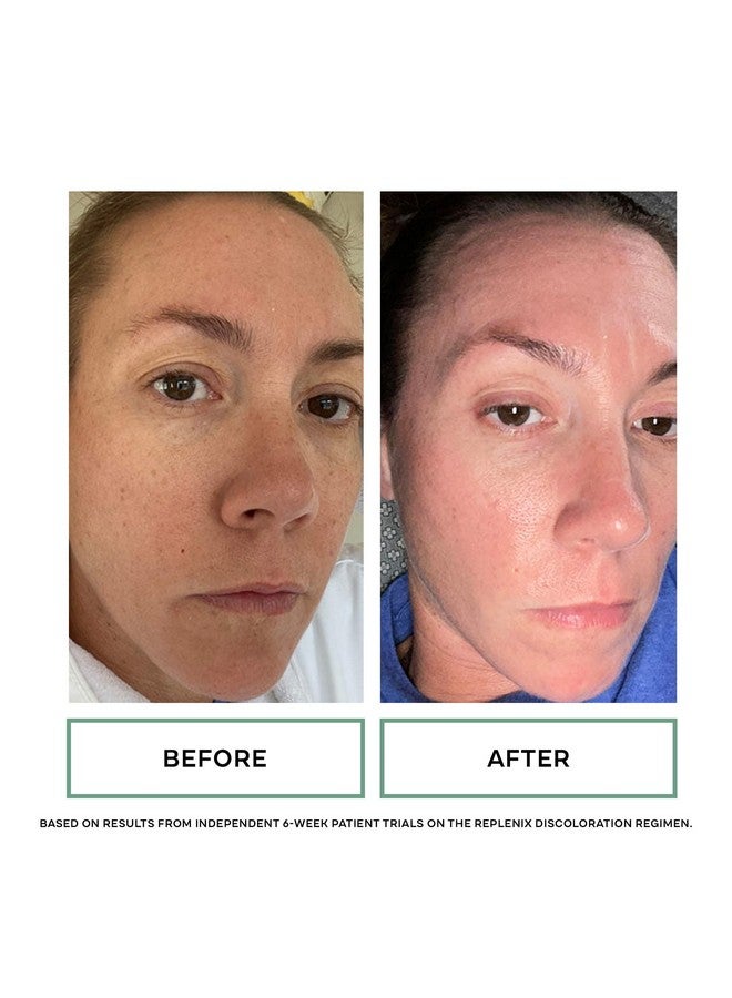 Replenix - Glycolix Elite Glycolic Acid Resurfacing Peel Pads - Medical Grade Brightening and Exfoliating Treatment, Travel Friendly Pads, 60 ct. - Image 5