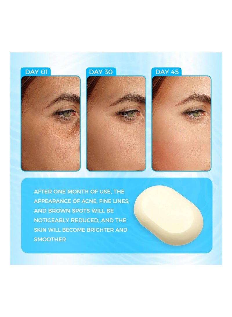 OUKEYA Sulfur Soap for Face Acne Treatment with Sulfur 10%, Salicylic Acid 2%, Goat Milk, Tea Tree, Hia Acid,Pharmaceutical Grade Dermatologists - Image 4