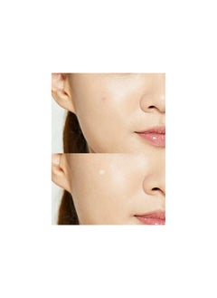 Cure aid Hydrocolloid spots Plaster 24pcs - transparent  - Image 3