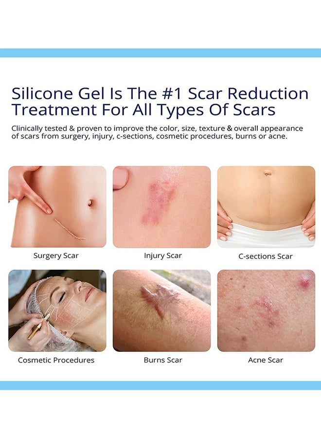 أسموكسا جل سيليكون متقدم لإزالة الندوب جل طبي للندوب للندوب الجراحية وحب الشباب وندبة القيصرية وجراحة شد البطن وعلامات التمدد والحروق للوجه يشفى وينعم ويجدد ويرطب البشرة جل إصلاح لجميع أنواع البشرة 30 جرام - Image 5