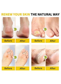 Sefudun 2 Packs 20PCS Herbal Foot Cleaning Soak Beads, Herbal Body Detox Foot Soak, Foot Spa Pedicure With Bath Salt, Foot Cream, Foot Scrub, Natural Herbal Foot Massage Beads For Men And Women  - Image 4
