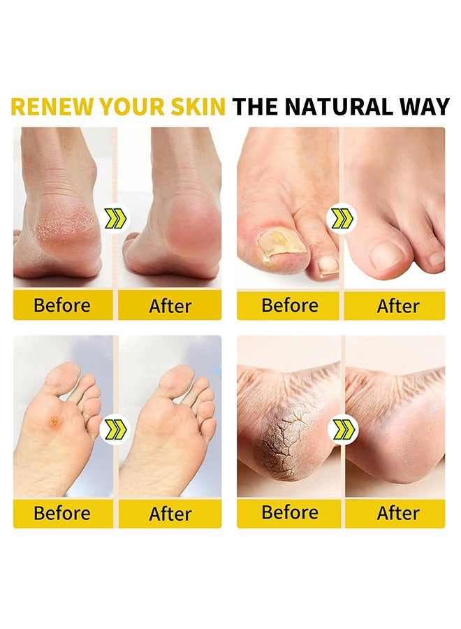 سيفودون 2 حزم 20 قطع العشبية تنظيف القدم نقع الخرز، العشبية الجسم السموم القدم نقع، القدم سبا باديكير مع ملح الحمام، كريم القدم، فرك القدم، الطبيعية العشبية تدليك القدم الخرز للرجال والنساء - Image 4