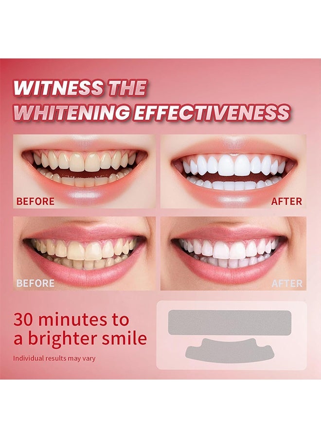 IVISMILE Express Teeth Whitening Strips, 14 Treatments Remove Years of Stains - Sensitive Teeth whitening Strips, Deep Stains Removal, Enamel Safe, Instant Teeth Whitening Without The Harm (28 Strips) - Image 4