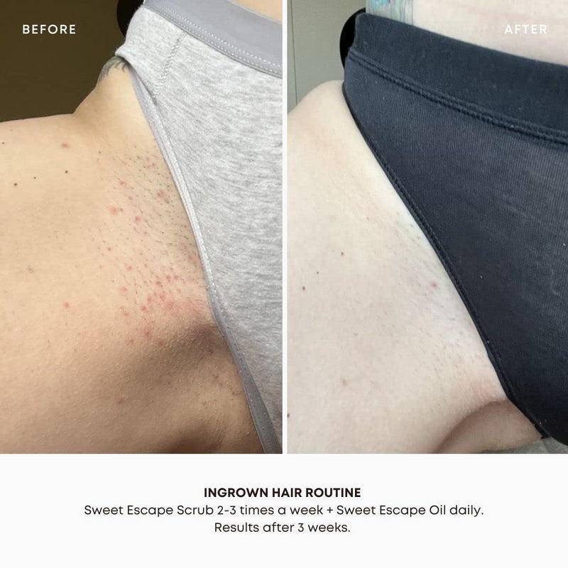 Bushbalm Ingrown Hair and Razor Bumps 2-Step Routine - Moisturize and Calm - Ingrown Hair Oil (30 ml) and Exfoliating Scrub (236 ml) - Sweet Escape - Image 3