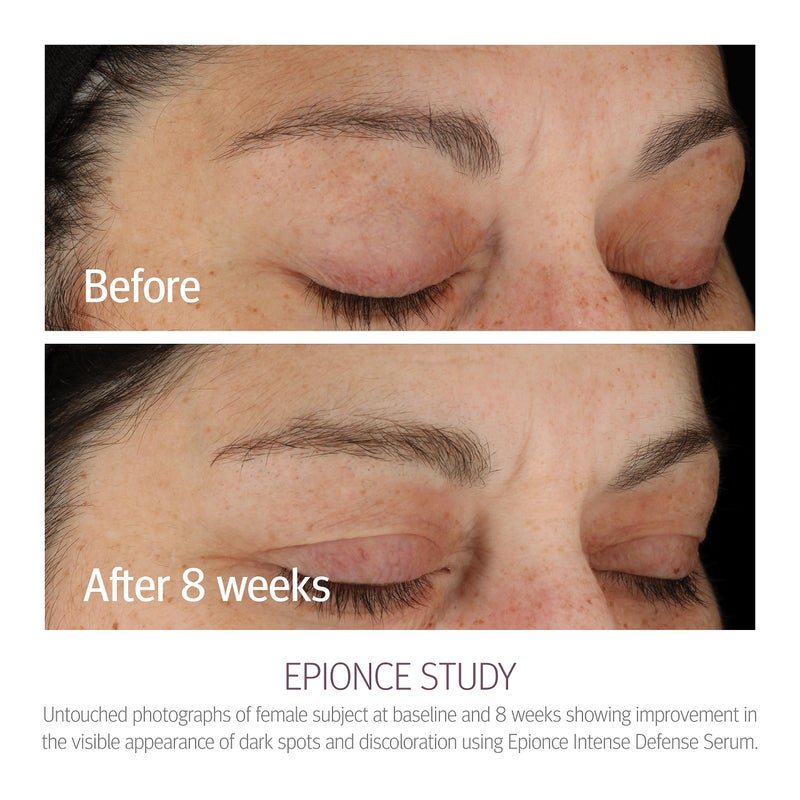 Epionce Intense Defense Serum - Anti-Aging Facial Serum with Vitamin C, Vitamin E, Vitamin D, A, B, & Niacinamide, Dermatologist Skincare - Image 3