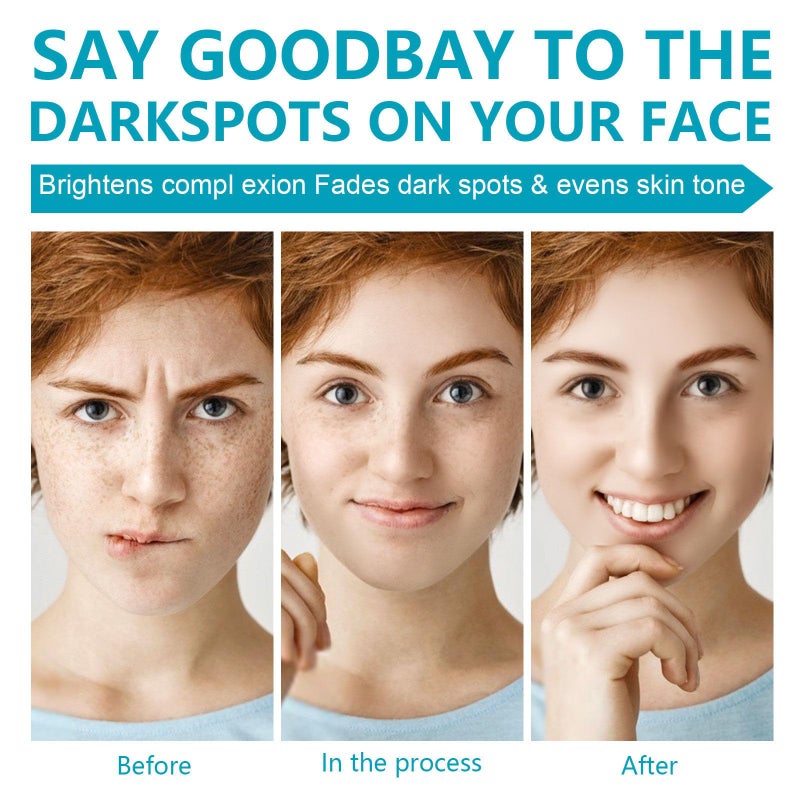 Rosarden مزيل البقع الداكنة للوجه والجسم، كريم تصحيح البقع الداكنة، كريم تصحيح البقع الداكنة للبقع العمرية، البقع، الكلف، النمش، مزيل البقع الشمسية ومخفف العيوب للنساء والرجال - Image 4