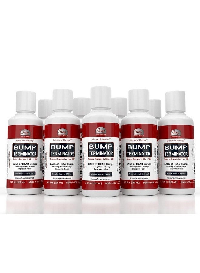 Breej BUMP TERMINATOR Severe Bumps Treatment | Razor Bumps And Ingrown Hair Treatment | Bikini Bumps | Back of Head Bumps And Ingrown Hair Treatment, 4 oz (Pack of 1) - Image 5