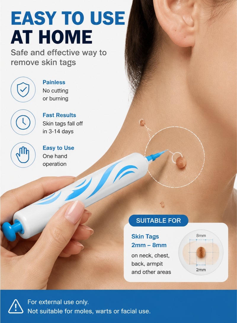 Majestic Skin Tag Removal Kit – Painless Skin Tag Remover Bands Tool for Neck & Body – Easy At Home Skin Tag Removal Device (2–8mm) - Image 2