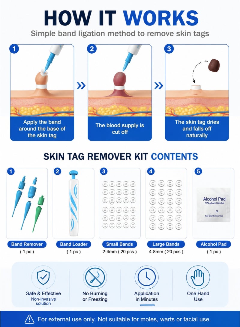 Majestic Skin Tag Removal Kit – Painless Skin Tag Remover Bands Tool for Neck & Body – Easy At Home Skin Tag Removal Device (2–8mm) - Image 3