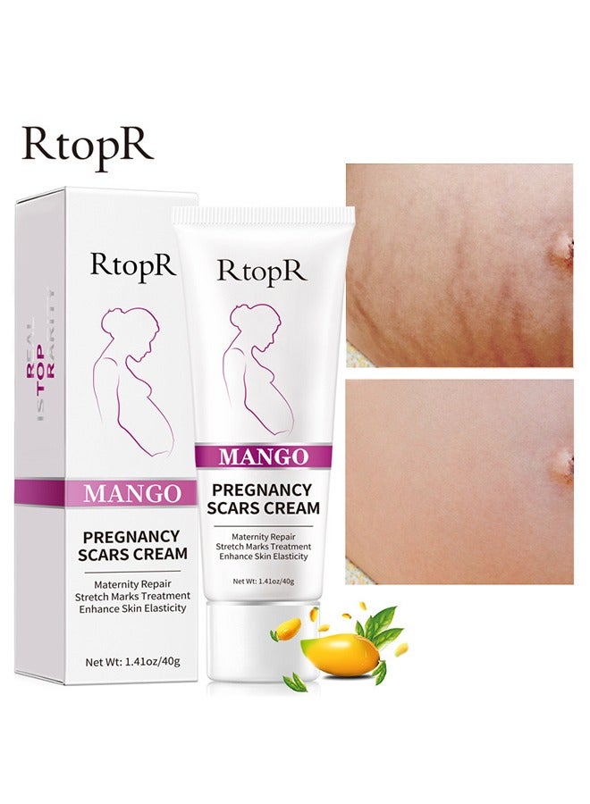 آر توب آر كريم ندوب الحمل المانجو لإصلاح علامات التمدد للأمومة يعزز مرونة الجلد ، ويمكن أن يعزز تجديد الخلايا ، ويصلح الخلايا الميتة ، المصممة لعلامات تمدد الأم - Image 1
