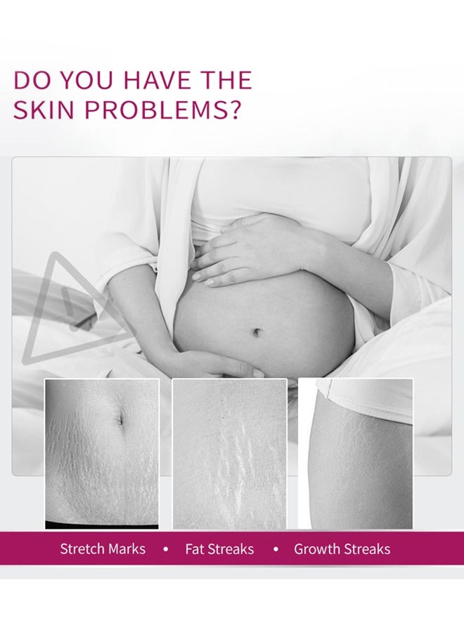 آر توب آر كريم ندوب الحمل المانجو لإصلاح علامات التمدد للأمومة يعزز مرونة الجلد ، ويمكن أن يعزز تجديد الخلايا ، ويصلح الخلايا الميتة ، المصممة لعلامات تمدد الأم - Image 3