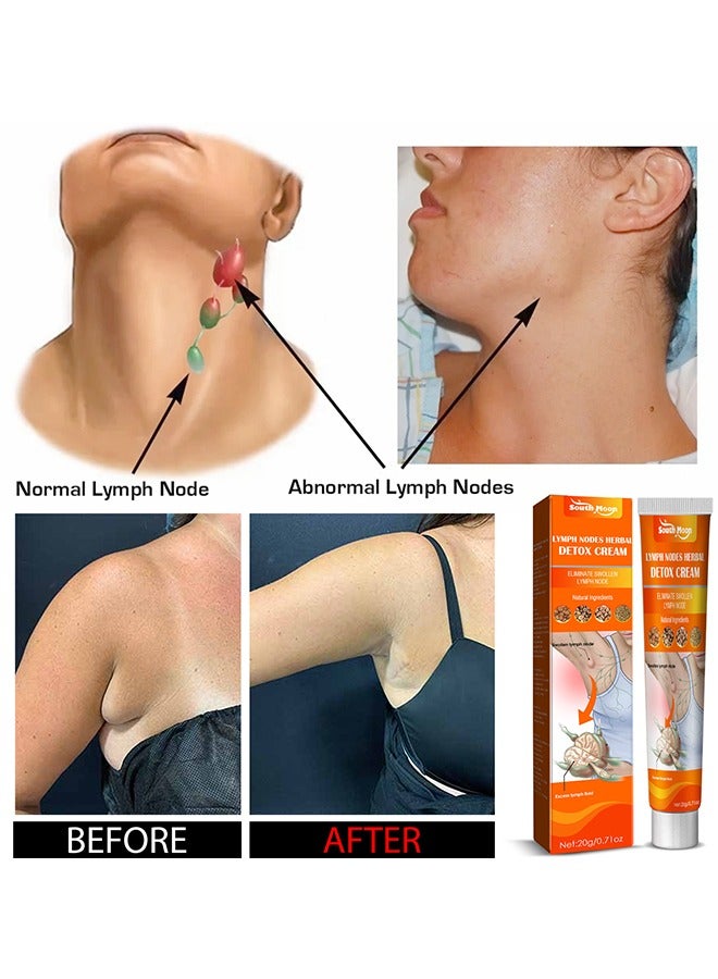 SOUTH MOON Lymphatic Detox Ointment Herbal Ingredients Fast Penetration Promote Metabolism Body Detoxify 20g - Image 5