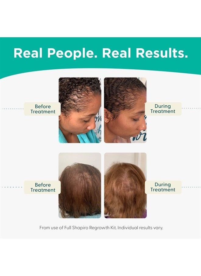 Shapiro MD Hair Growth Experts - Women's Regrowth Kit Plus: Shampoo, Conditioner, 2% Minoxidil, Leave-In Foamer. Anti Hair Loss and Thinning Hair Solution for Women, 1 Month - Image 1
