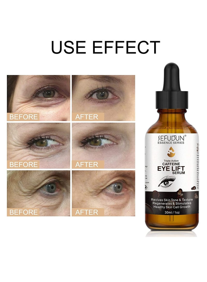 Sefudun Triple Action Caffeine Eye Lift Serum with EGCG Vitamin C Hyaluronic Acid Collagen Caffeine Eye Serum Reduces Puffiness Dark Circles Under Eye Bags Wrinkles and Fine Lines Around the Eyes 30ml  - Image 3
