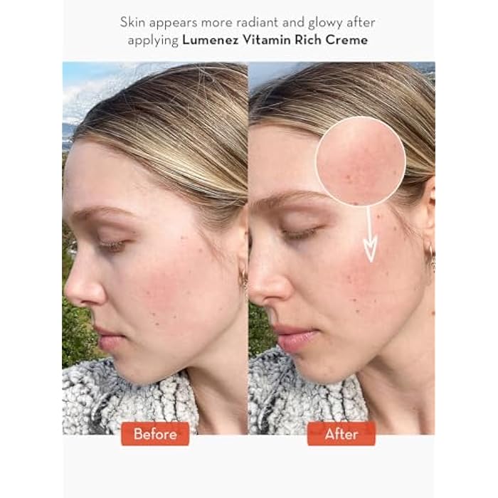 SONAGE Lumenez Vitamin Facial Cream: Daily Restorative Moisturizer with Vitamin C | Hydrating Cream for Dry Skin - Image 5