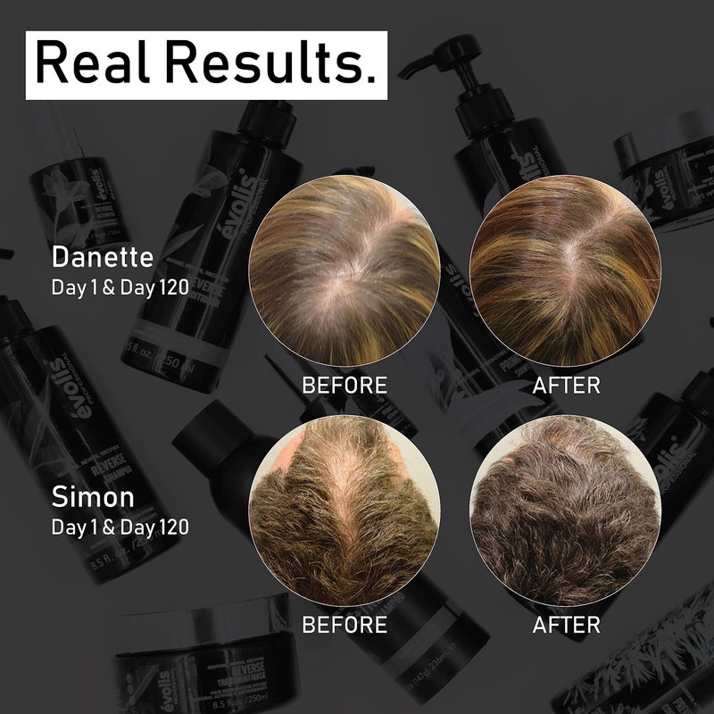 EVOLIS Promote Nourishing Treatment Mask - Deep Conditioning Hair Mask to Support Hair Growth - Hydrating Hair Mask for Dry, Damaged Hair - Travel Size (1 fl oz) - Image 3