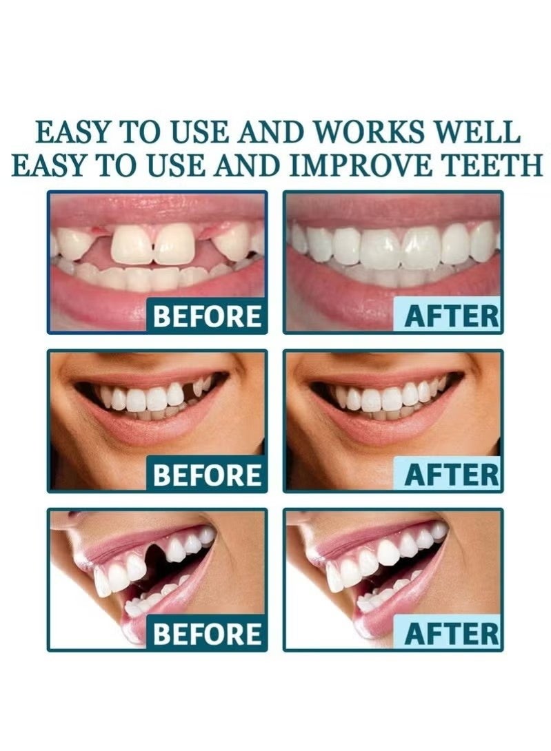 EELHOE 1 Pairs Temporary Teeth Perfect Cover, Cosmetic Veneers Teeth Temporary Dentures, Adjustable Snap On, Moldable False Teeth for Beautiful Smile, Nature and Comfortable, Fit Whitening Flex Denture Cover，Teeth Veneers Whitening Dentures - Image 3