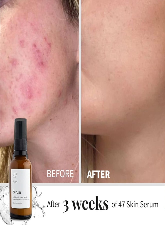 47 Skin سيروم ترطيب الوجه 47 للبشرة لعلاج حب الشباب والندبات، سيروم إصلاح عيوب البشرة والندبات مع شيتوديرم الفضي، سيروم مرطب للبشرة الناعمة لجميع أنواع البشرة (1.69 أونصة)  - Image 4