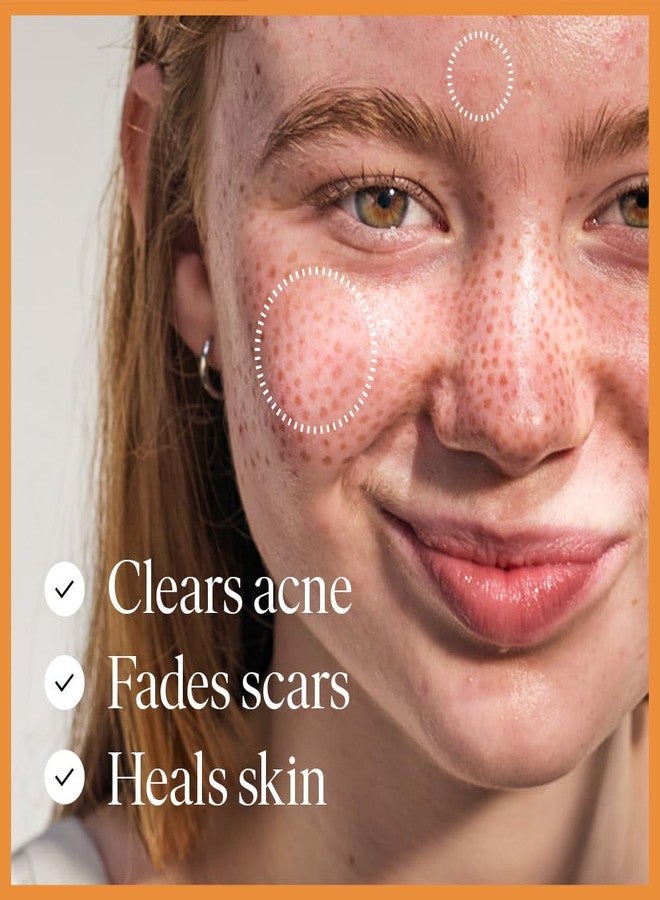 47 Skin سيروم ترطيب الوجه 47 للبشرة لعلاج حب الشباب والندبات، سيروم إصلاح عيوب البشرة والندبات مع شيتوديرم الفضي، سيروم مرطب للبشرة الناعمة لجميع أنواع البشرة (1.69 أونصة)  - Image 2