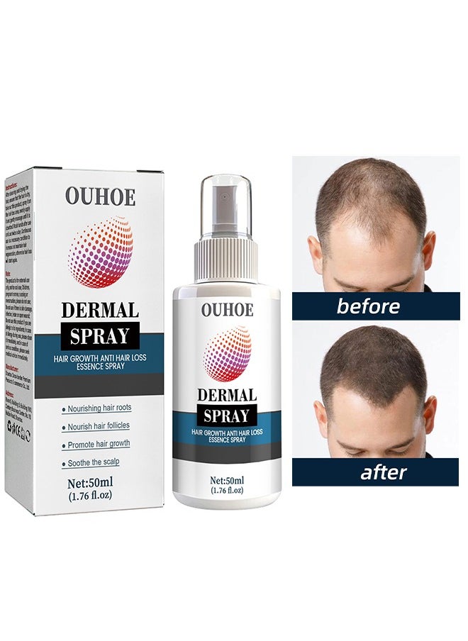 OUHOE - Hair Growth Anti Hair Loss Essence Spray, Ultra Hair Growth Formula Serum Spray, Damaged Dry Hair, Hair Regrowth For Thicker Longer Fuller Hair With Castor Oil Ginger 50ML - Image 1