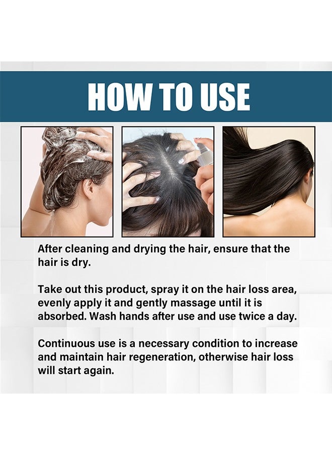 OUHOE - Hair Growth Anti Hair Loss Essence Spray, Ultra Hair Growth Formula Serum Spray, Damaged Dry Hair, Hair Regrowth For Thicker Longer Fuller Hair With Castor Oil Ginger 50ML - Image 1