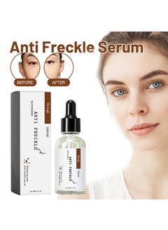 Niacinamide Anti Freckle Serum，Niacinamide Spot Correcting Serum | Hydrating, Skin Brightening, Dark Spot Fading & Skin Rejuvenating Essence 30ml