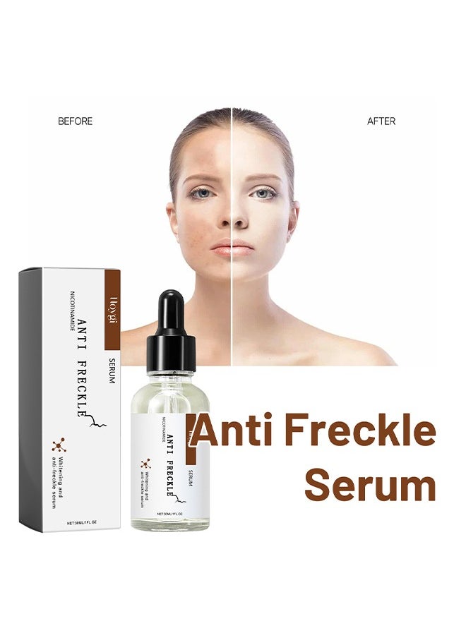 Hoygi - Niacinamide Anti Freckle Serum，Niacinamide Spot Correcting Serum | Hydrating, Skin Brightening, Dark Spot Fading & Skin Rejuvenating Essence 30ml - Image 1