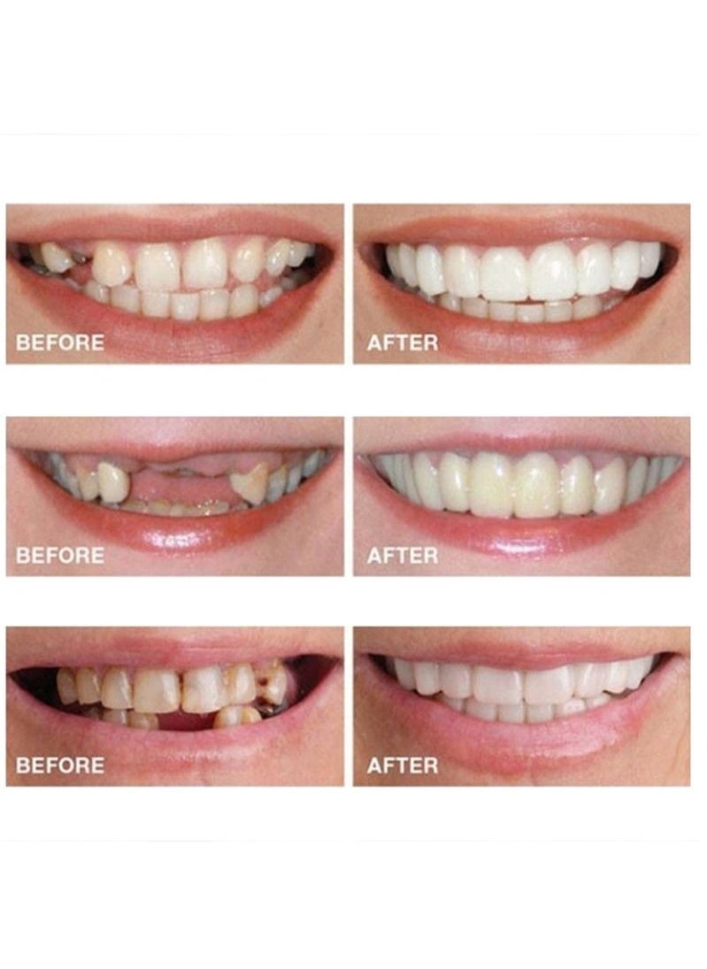 Ocean Snap-On Smile Veneers: Removable Comfortable Veneer Covers for Teeth Whitening & Dental Alignment，Alternative to Traditional Braces  - Image 5