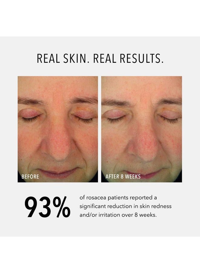 HydroPeptide سيروم مهدئ: إصلاح وراحة الاحمرار 30 مل/1 أونصة - Image 4