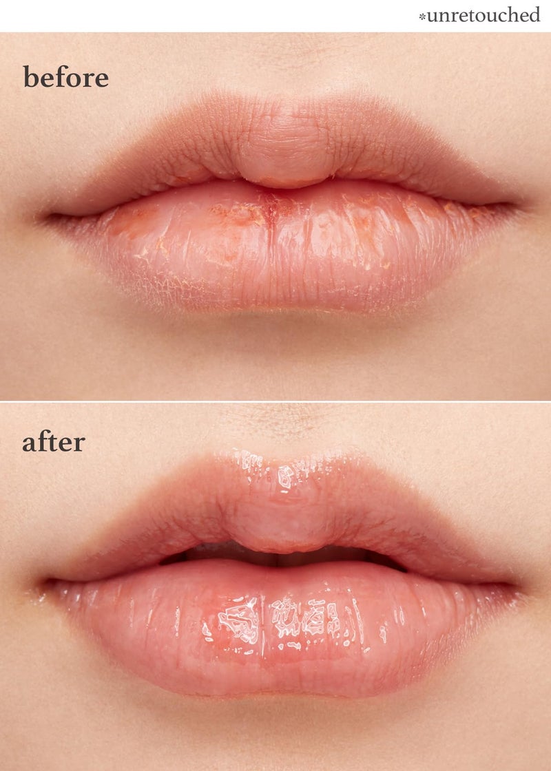 NOONI Korean Lip Butter Melting Balm (Applebutter) with Shea Butter and Vitamins | Hydrating, Nourishing, Lip Butter, Lip Balm, Soothing, Moisturizing, Softening, Korean Skincare - Image 3