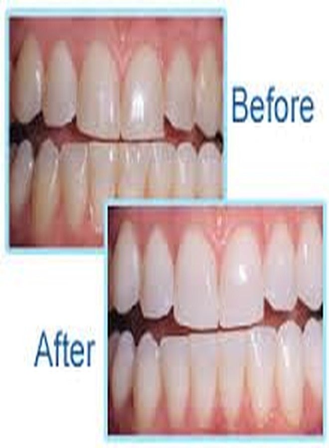 Expertwhite Prefilled+ On-The Go Teeth Whitening Trays Kit: Ready to use. PH Balanced 12% Hydrogen Peroxide Gel Filled - No Sensitivity - On-The-Go Better Than Strips Pen. Teeth (20 Trays 10-Pack) - Image 4