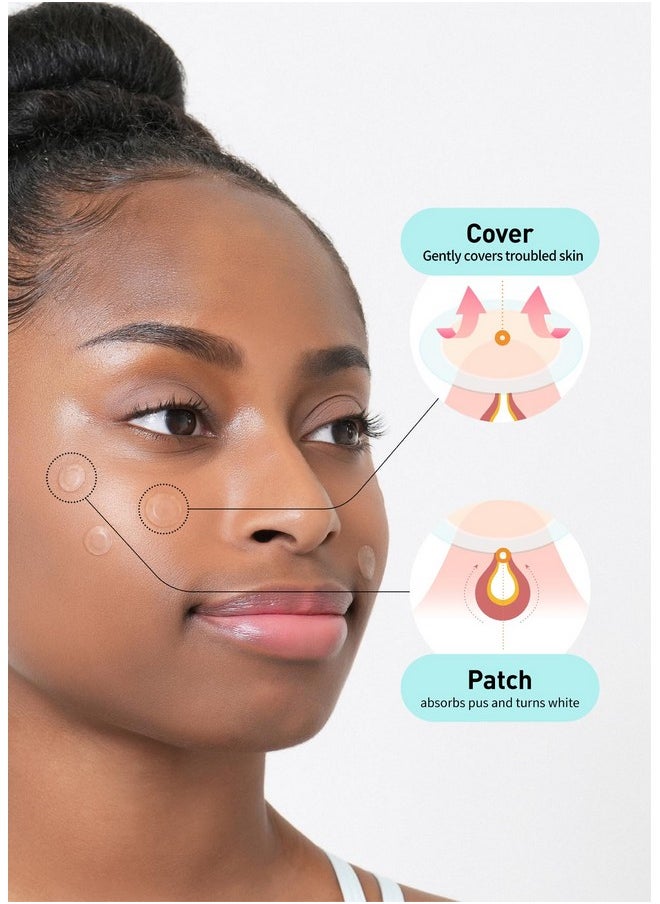 OLIVE YOUNG - Oliveyoung Careplus Big Size Acne Spot Patches 81Count (12Mm45Ea+14Mm36Ea)Extra Coverage Zit Absorbing Cover Patch Moist Wound Dressing For Skin Trouble Korean Invisible Pimple Hydrocolloid Stickers - Image 1