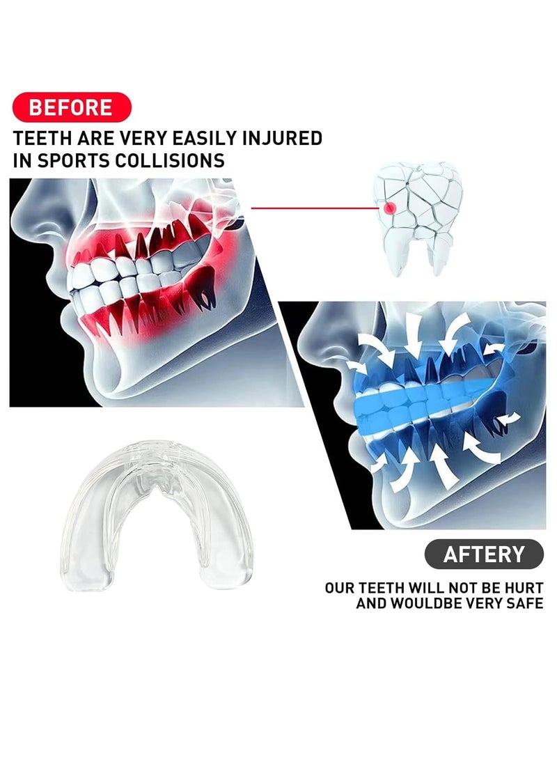 Excefore 3 عبوات واقي فم للأطفال والشباب، دعامات رياضية لكرة القدم، واقيات فم لمصارعة MMA، الملاكمة، الرجبي، الكيك بوكسينغ، التايكوندو، سوفت بول، لاكروس لدعامات EVA شفافة - Image 2