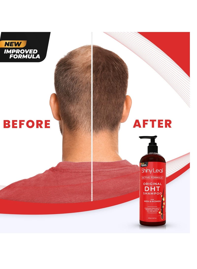 Shiny Leaf Anti-Hair Loss Shampoo With Biotin, for Men & Women - Sulfate-Free, Natural DHT Blocking Formula for Hair Growth, Thinning Hair Prevention, 16 Oz  - Image 5
