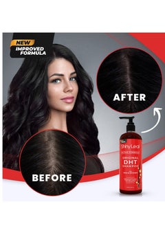 Shiny Leaf Anti-Hair Loss Shampoo With Biotin, for Men & Women - Sulfate-Free, Natural DHT Blocking Formula for Hair Growth, Thinning Hair Prevention, 16 Oz  - Image 4