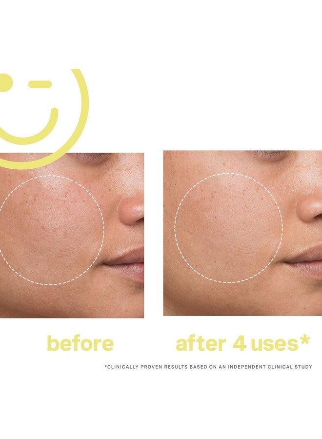 كيت سمرفيل كيت سومرفيل ميجا-سي ٣٠٪ فيتامين سي لتفتيح الوجه - قناع تفتيح قوي من الدرجة الطبية، ٢ أونصة سائلة - Image 5