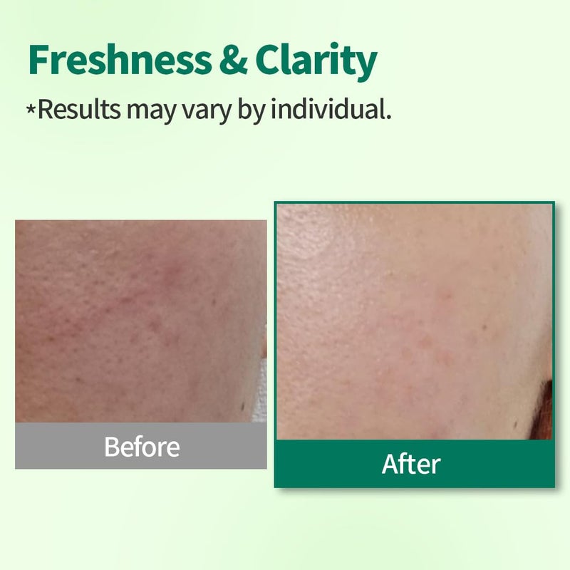 1.618 Korean Foam Face Wash - pH 6.5 Balanced Tea Tree Cleanser â€“ Salicylic Acid & Plant-Based Formula for Blemish-Prone, Oily Skin | 5.07 oz - Image 3