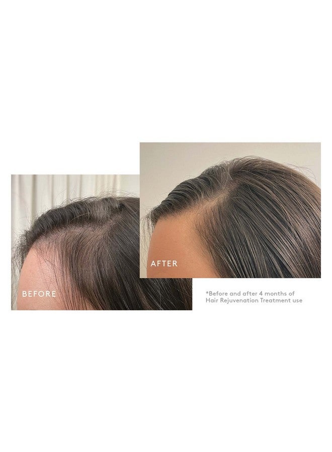 فيرتشو نظام فيرتشو فلوريش لنمو الشعر ١٠٠٪ بدون أدوية | مجموعة شهر واحد - Image 5