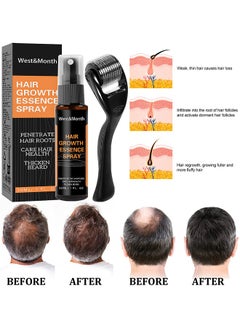 West&Month 30ML Hair Growth Essence Spray, Anti-Slip Hair Nourishing Growth Liquid Thickening Hairline Essence Spray With Microne Roller, Hair Loss And Thinning Prevention Treatment, Scalp Improver  - Image 5